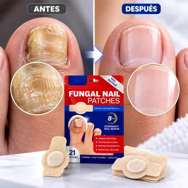 DermaPatch | Parche Antifungico Para Uñas | Original 2X1