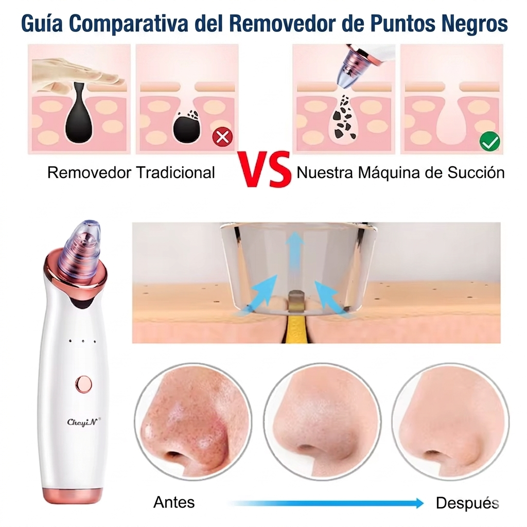 Extractor de punto negros