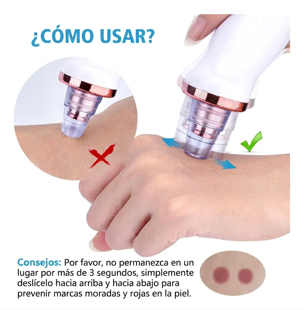 Extractor de punto negros