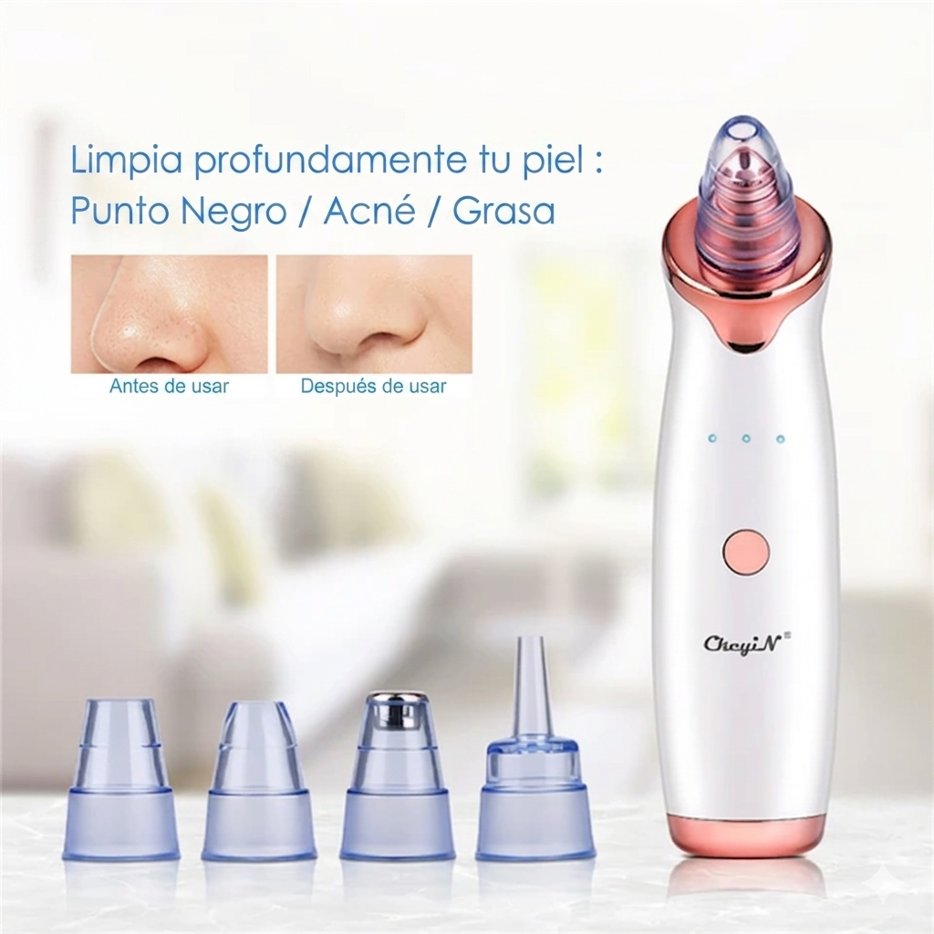 Extractor de punto negros
