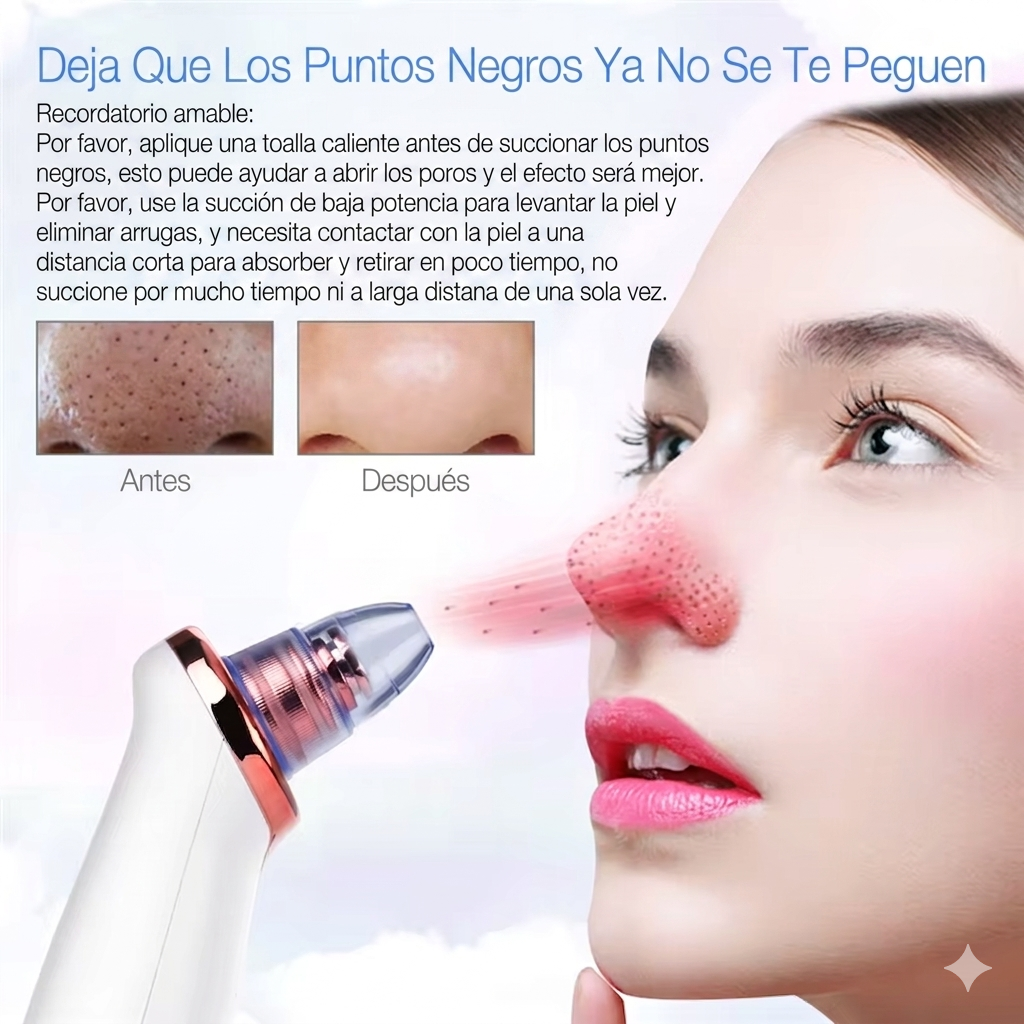 Extractor de punto negros