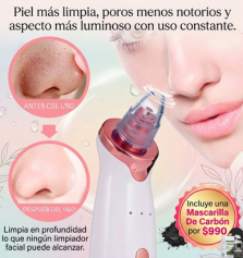 Extractor de punto negros